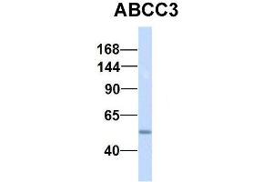 Host:  Rabbit  Target Name:  NSUN6  Sample Type:  Human Fetal Lung  Antibody Dilution:  1. (ABCC3 抗体  (Middle Region))