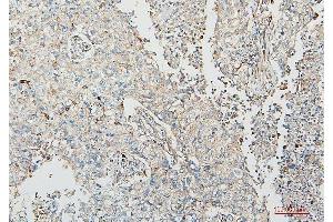 IHC analysis of COMT using anti-COMT antibody (ABIN7601948).