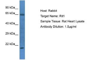 Host: Rabbit Target Name: Rit1 Sample Type: Rat Heart lysates Antibody Dilution: 1. (RIT1 抗体  (N-Term))