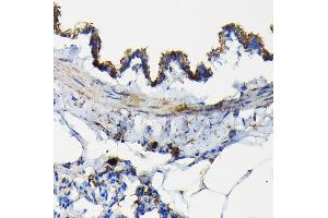 Immunohistochemistry of paraffin-embedded rat lung using TNFR1/TNFRSF1A Rabbit pAb (ABIN3022103, ABIN3022104, ABIN1513619 and ABIN6218606) at dilution of 1:100 (40x lens).
