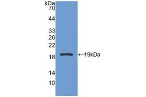 Detection of Recombinant GCA, Human using Polyclonal Antibody to Grancalcin (GCA) (Grancalcin 抗体  (AA 1-139))