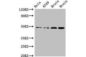 Western Blot Positive WB detected in: Hela whole cell lysate, A549 whole cell lysate, Rat brain tissue, Mouse brain tissue All lanes: GJA8 antibody at 2. (GJA8 抗体  (AA 286-432))