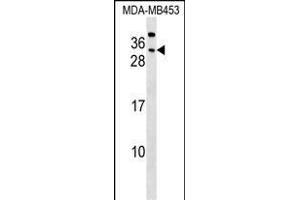 CEAC Antibody (Center) (ABIN1537760 and ABIN2848792) western blot analysis in MDA-M cell line lysates (35 μg/lane). (CEACAM7 抗体  (AA 112-140))
