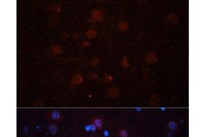Immunofluorescence analysis of Rat brain using ASPN Polyclonal Antibody at dilution of 1:100 (40x lens). (Asporin 抗体)