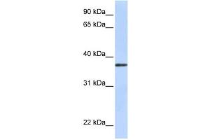 Western Blotting (WB) image for anti-Transmembrane Protein 200B (TMEM200B) antibody (ABIN2458847) (TMEM200B 抗体)