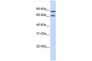 Western Blotting (WB) image for anti-IKAROS Family Zinc Finger 1 (Ikaros) (IKZF1) (Middle Region) antibody (ABIN2777317)