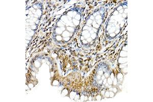 Immunohistochemistry of paraffin-embedded rat liver using Phospho--S473 Rabbit mAb (ABIN6135179, ABIN6135970, ABIN6135971 and ABIN7101880) at dilution of 1:100 (40x lens). (AKT1 抗体  (pSer473))