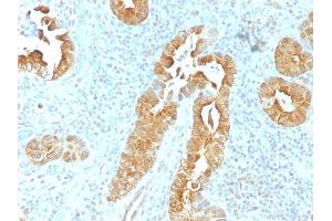 Formalin-fixed, paraffin-embedded human Rectum stained with Villin Mouse Monoclonal Antibody (VIL1/1325). (Villin 1 抗体  (AA 179-311))
