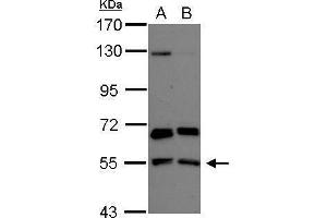 WB Image Sample (30 ug of whole cell lysate) A: NT2D1 B: U87-MG 7.