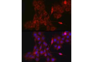 Immunofluorescence (IF) image for anti-NLR Family, Pyrin Domain Containing 1 (NLRP1) (AA 1000-1100) antibody (ABIN7268935)
