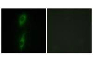 Immunofluorescence (IF) image for anti-Activin A Receptor Type II-Like 1 (ACVRL1) antibody (ABIN7183058)