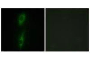 Immunofluorescence analysis of HeLa cells, using ACVL1 antibody. (ACVRL1 抗体)