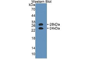 Western blot analysis of the recombinant protein. (ORM1 抗体  (AA 19-207))