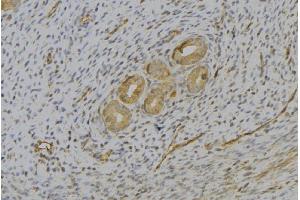 ABIN6277074 at 1/100 staining Human uterus tissue by IHC-P. (IL-13 抗体  (N-Term))