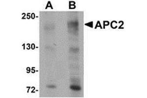 Western blot analysis of APC2 in HeLa cell lysate with AP30058PU-N APC2 antibody at (A) 1 and (B) 2 μg/ml. (APC2 抗体  (Center))
