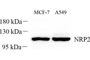 Western blot analysis of NRP2 (ABIN7074826) at dilution of 1: 300 (NRP2 抗体)