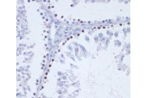 Immunohistochemistry of paraffin-embedded Rat testis using Phospho-γH2A. (gamma H2AX 抗体  (pSer139))