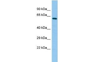Host: Rabbit Target Name: YTHDF2 Sample Type: MCF7 Whole Cell lysates Antibody Dilution: 1. (YTHDF2 抗体  (C-Term))