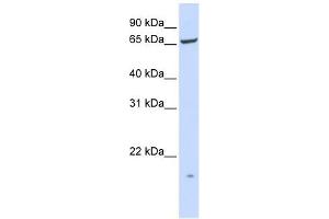 PIGT antibody used at 1 ug/ml to detect target protein. (Prolipoprotein Diacylglyceryl Transferase 抗体  (N-Term))