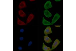 ABIN7097113 and ABIN7101180 staining Hela cells(30 min of UV treatment) by IF/ICC.