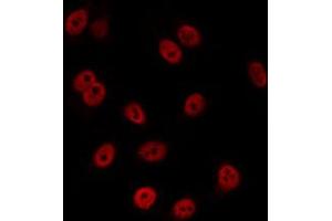 anti-Cyclin-Dependent Kinase Inhibitor 1C (p57, Kip2) (CDKN1C) (C-Term) antibody