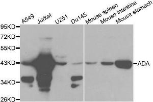 Western blot analysis of extracts of various cell lines, using ADA antibody. (ADA 抗体  (AA 1-363))
