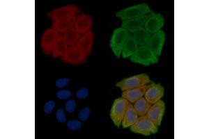 ABIN6257992 and ABIN6275831 staining Hela cells(45 min of heat-shock treatment) by IF/ICC. (TRAF2 抗体  (C-Term))