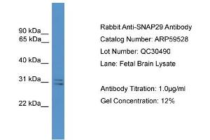 WB Suggested Anti-SNAP29  Antibody Titration: 0. (SNAP29 抗体  (Middle Region))