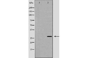 Western blot analysis of extracts of SH-SY5Y  , using BDNF antibody. (BDNF 抗体  (Internal Region))