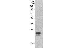 Western Blot (WB) analysis of HeLa cells using SRY Polyclonal Antibody. (SRY 抗体  (Internal Region))