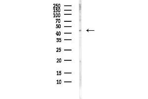 Western blot analysis of lysates from EC304 cells(LPS, 4h treatment), using PKR2 Antibody at 1/1000 dilution.
