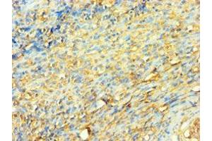 Immunohistochemistry of paraffin-embedded human tonsil tissue using ABIN7175904 at dilution of 1:100 (XRCC5 抗体  (AA 543-732))
