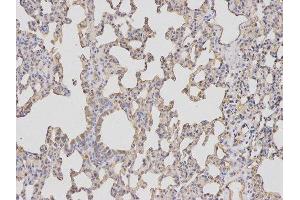 Immunohistochemistry (IHC) image for anti-Baculoviral IAP Repeat-Containing 5 (BIRC5) antibody (ABIN1875407) (Survivin 抗体)