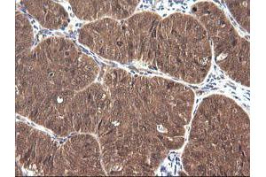 Image no. 2 for anti-Cancer/testis Antigen 1B (CTAG1B) antibody (ABIN1499895) (CTAG1B 抗体)
