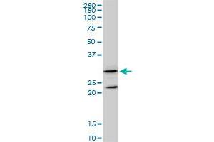 GSTZ1 monoclonal antibody (M01), clone 1G12. (GSTZ1 抗体  (AA 109-216))