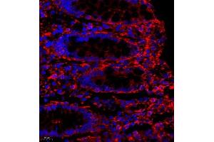 Immunofluorescence of paraffin embedded human colon using MYL6 (ABIN7074734) at dilution of 1:650 (400x lens)