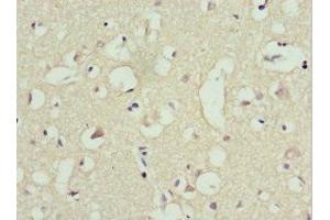 Immunohistochemistry of paraffin-embedded human brain tissue using ABIN7151243 at dilution of 1:100 (TRIM13 抗体  (AA 40-310))