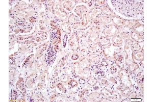 Immunohistochemistry (IHC) image for anti-Protein Kinase, AMP-Activated, alpha 2 Catalytic Subunit (PRKAA2) (AA 351-450) antibody (ABIN680458)