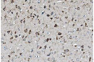IHC analysis of MEK2/MAP2K2 using anti-MEK2/MAP2K2 antibody (ABIN7599357). (MEK2 抗体  (AA 1-400))