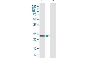 Western Blot analysis of COMT expression in transfected 293T cell line by COMT MaxPab polyclonal antibody. (COMT 抗体  (AA 1-221))