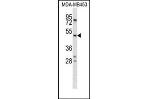 Western blot analysis of SERPINA5 Antibody (N-term) Cat. (SERPINA5 抗体  (N-Term))