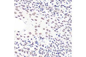 Immunohistochemistry of paraffin-embedded human tonsil using H3K36me2 antibody. (Histone 3 抗体  (H3K36me2))