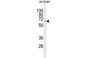 Western blot analysis in mouse liver tissue lysates (35ug/lane) using KY Antibody (N-term). (Kyphoscoliosis Peptidase 抗体  (N-Term))