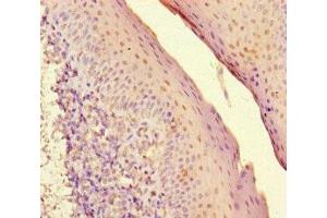 Immunohistochemistry of paraffin-embedded human tonsil tissue using ABIN7155525 at dilution of 1:100 (SUV39H1 抗体  (AA 179-412))