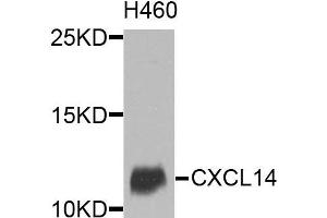 Western blot analysis of extracts of various cells, using CXCL14 antibody. (CXCL14 抗体)