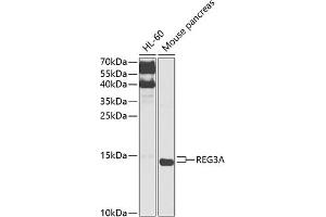 Western blot analysis of extracts of various cell lines, using REG3A antibody (ABIN6132545, ABIN6146855, ABIN6146856 and ABIN6216122) at 1:1000 dilution. (REG3A 抗体  (AA 27-175))