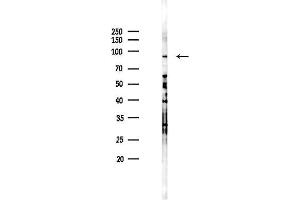 Western blot analysis of lysates from K562 cells(heat-shock 45 min treatment), using Phospho-PI3K p85 alpha (Tyr607) Antibody at 1/1000 dilution.