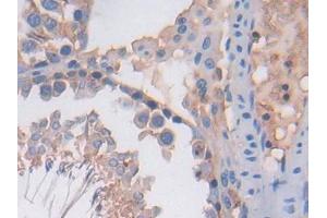 DAB staining on IHC-P; Samples: Rat Testis Tissue (PF4 抗体  (AA 30-105))