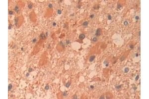 Immunohistochemistry (IHC) image for anti-Pyruvate Kinase, Liver and RBC (PKLR) (AA 219-420) antibody (ABIN7431302)