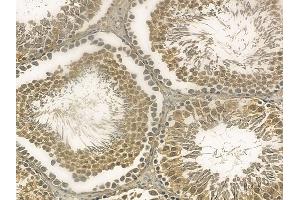 LCHN Mouse Monoclonal Antibody at 1/100 staining rat testis tissue by IHC-P. (DENND11/KIAA1147 抗体)